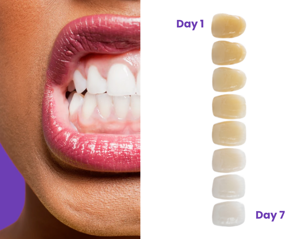 DAY 7